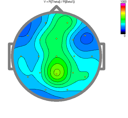 QEEG / Brain Mapping Report and Neurotherapy Recommendations
